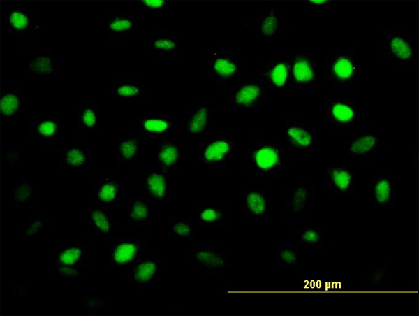 3 - ZNF24 Antibody (monoclonal) (M02) AT4612a