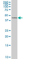 1 - ZNF24 Antibody (monoclonal) (M02) AT4612a