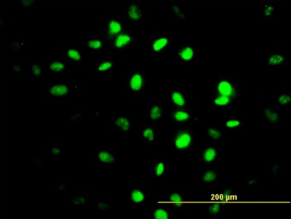 3 - ZNF24 Antibody (monoclonal) (M03) AT4613a