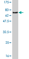 1 - ZNF24 Antibody (monoclonal) (M03) AT4613a