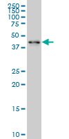 1 - ZNF24 Antibody (monoclonal) (M03) AT4613a