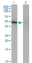 1 - ZNF24 Antibody (monoclonal) (M03) AT4613a