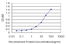 10 - ZNF263 Antibody (monoclonal) (M02) AT4615a