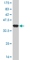 1 - ZNF263 Antibody (monoclonal) (M02) AT4615a