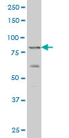 1 - ZNF263 Antibody (monoclonal) (M02) AT4615a