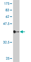 1 - ZNF263 Antibody (monoclonal) (M03) AT4616a