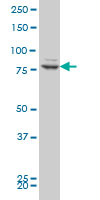 1 - ZNF263 Antibody (monoclonal) (M03) AT4616a