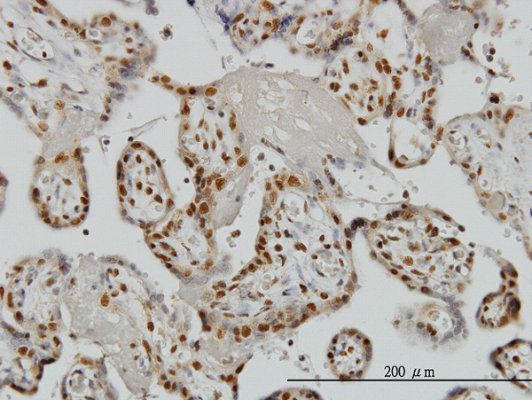 2 - ZNF265 Antibody (monoclonal) (M01) AT4617a