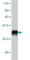 1 - ZNF265 Antibody (monoclonal) (M01) AT4617a