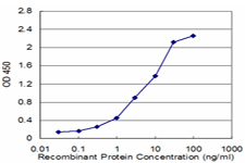 10 - ZNF265 Antibody (monoclonal) (M02) AT4618a