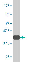 1 - ZNF265 Antibody (monoclonal) (M02) AT4618a