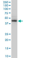 1 - ZNF265 Antibody (monoclonal) (M02) AT4618a