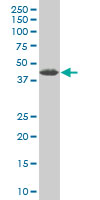 1 - ZNF265 Antibody (monoclonal) (M02) AT4618a