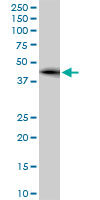 1 - ZNF265 Antibody (monoclonal) (M02) AT4618a