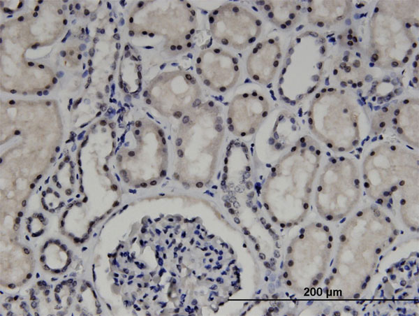 2 - ZNF266 Antibody (monoclonal) (M02) AT4619a