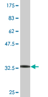 1 - ZNF266 Antibody (monoclonal) (M02) AT4619a