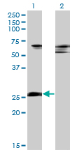 1 - ZNF266 Antibody (monoclonal) (M02) AT4619a