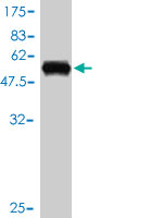1 - ZNF277 Antibody (monoclonal) (M01) AT4622a