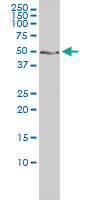 1 - ZNF277 Antibody (monoclonal) (M01) AT4622a