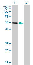 1 - ZNF277 Antibody (monoclonal) (M01) AT4622a