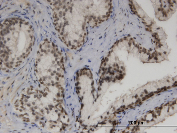 2 - ZNF3 Antibody (monoclonal) (M08) AT4624a