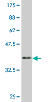 1 - ZNF3 Antibody (monoclonal) (M08) AT4624a