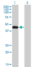 1 - ZNF3 Antibody (monoclonal) (M08) AT4624a