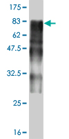 1 - ZNF31 Antibody (monoclonal) (M02) AT4625a