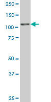 1 - ZNF31 Antibody (monoclonal) (M02) AT4625a