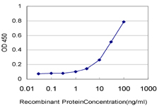 10 - ZNF31 Antibody (monoclonal) (M04) AT4626a