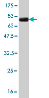 1 - ZNF31 Antibody (monoclonal) (M04) AT4626a