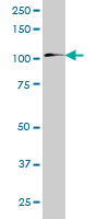 1 - ZNF31 Antibody (monoclonal) (M04) AT4626a