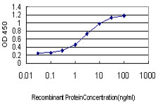 10 - ZNF345 Antibody (monoclonal) (M01) AT4628a