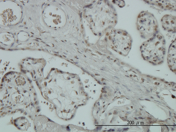 2 - ZNF345 Antibody (monoclonal) (M01) AT4628a