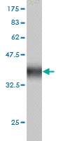 1 - ZNF345 Antibody (monoclonal) (M01) AT4628a