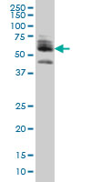 1 - ZNF345 Antibody (monoclonal) (M01) AT4628a