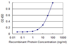 10 - ZNF396 Antibody (monoclonal) (M01) AT4635a