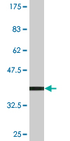1 - ZNF396 Antibody (monoclonal) (M01) AT4635a