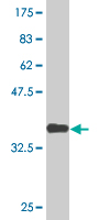 1 - ZNF397 Antibody (monoclonal) (M02) AT4636a