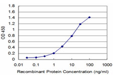 10 - ZNF496 Antibody (monoclonal) (M02) AT4639a