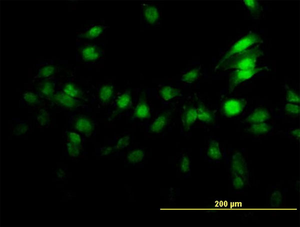 3 - ZNF496 Antibody (monoclonal) (M02) AT4639a