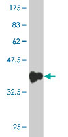 1 - ZNF496 Antibody (monoclonal) (M02) AT4639a