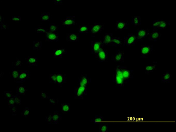3 - ZNF496 Antibody (monoclonal) (M08) AT4640a