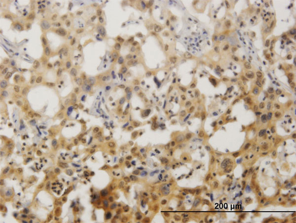 2 - ZNF496 Antibody (monoclonal) (M08) AT4640a