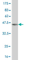 1 - ZNF496 Antibody (monoclonal) (M08) AT4640a