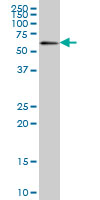 1 - ZNF496 Antibody (monoclonal) (M08) AT4640a
