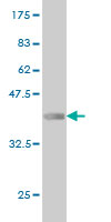1 - ZNF650 Antibody (monoclonal) (M01) AT4643a