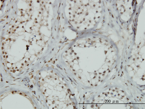 2 - ZNF85 Antibody (monoclonal) (M02) AT4645a