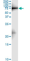 5 - ZYX Antibody (monoclonal) (M01) AT4653a