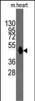 1 - Evx2 Antibody (N-term) AP1427a